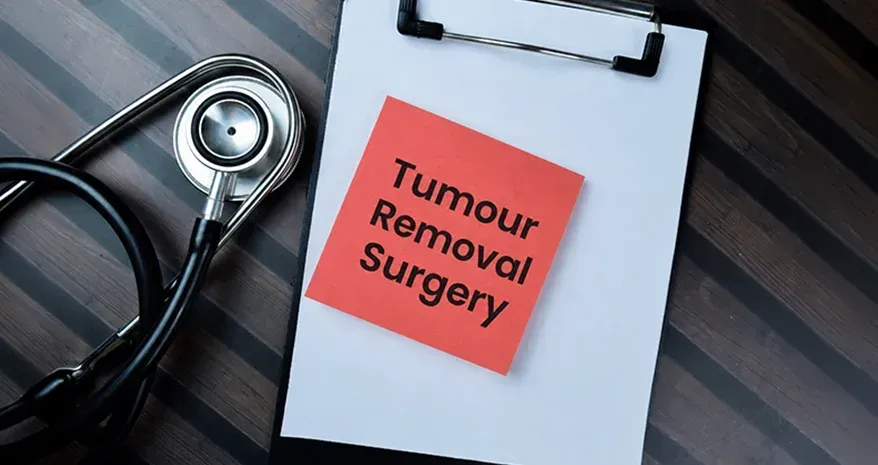 Star System Risk Tumour Removal Surgery - Need, Benefits & Risks