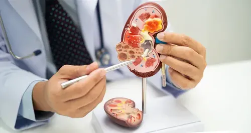 Chronic Kidney Disease Progression and Stages