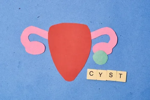 A Complete Guide to Ovarian Cysts