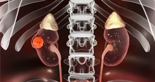 Adrenal Gland Disorder Treatments: A Guide to Hormone Health