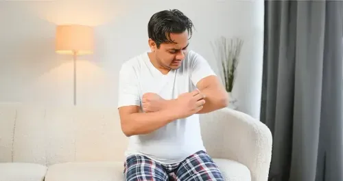 Skin Allergy