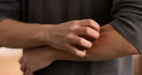 Treatments for Skin Allergies and Rashes