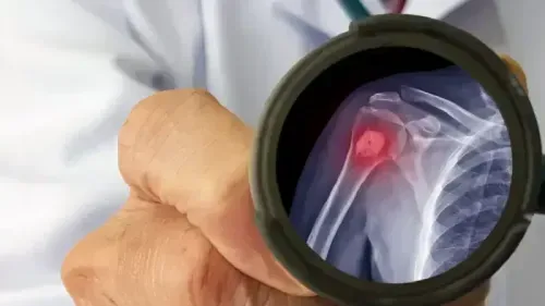 Health Insurance for Bone Cancer