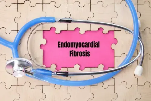 Endomyocardial Fibrosis - Causes, Symptoms, Treatment