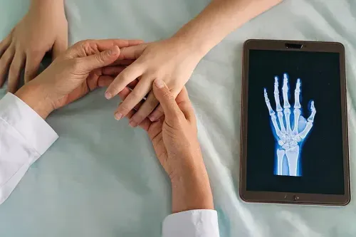 Health Insurance Coverage for Paget’s Disease of Bone