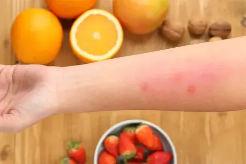 What is Health Insurance for Food Allergy Management?