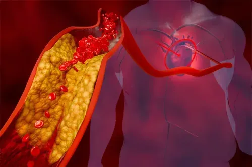 Health Insurance for Hyperlipidaemia Management