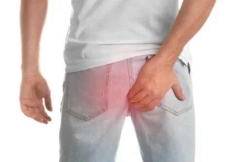 Price of Hemorrhoidectomy (Piles Surgery) in Pune