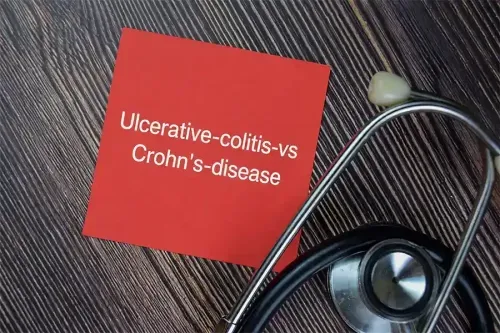 What is the Difference Between Ulcerative Colitis and Crohn’s Disease? 
