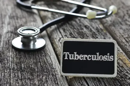 How is Tuberculosis Detected?