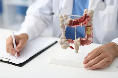 How to Prevent Colitis?