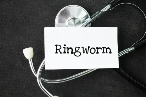 How to Prevent Ringworm?