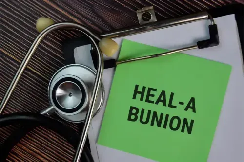 How to Manage a Bunion?