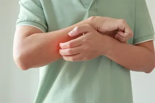 How to Treat Chigger Bites at Home?
