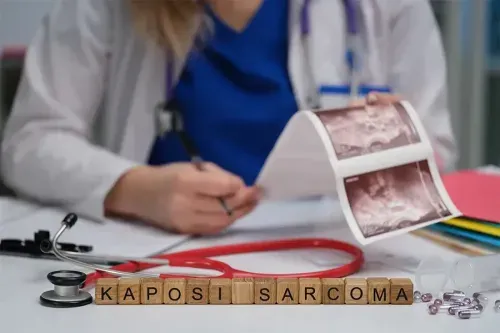 Kaposi Sarcoma - Causes, Risk Factors and Treatment