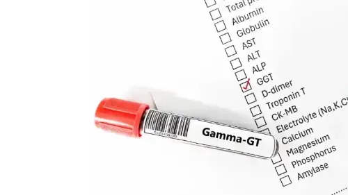 What Level of GGT is Dangerous?