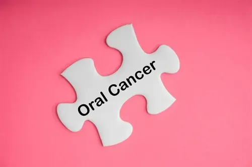 Major Risks Factors for Oral Cancer