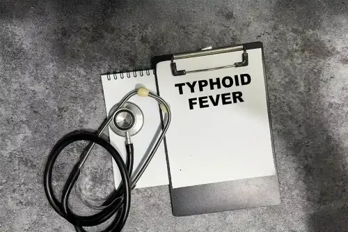 Key Risk Factors for Typhoid Fever?