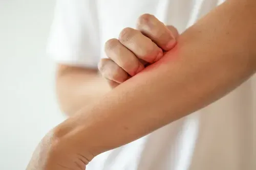 How is Polycythaemia Vera Treated in Hyderabad?