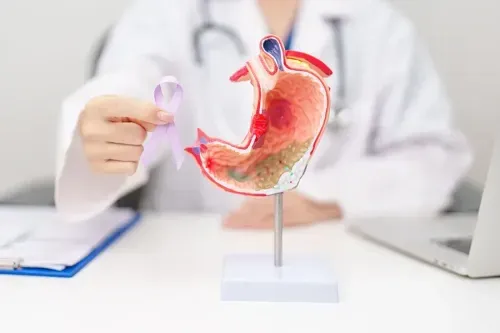 What are the Risk factors for Stomach Cancer?