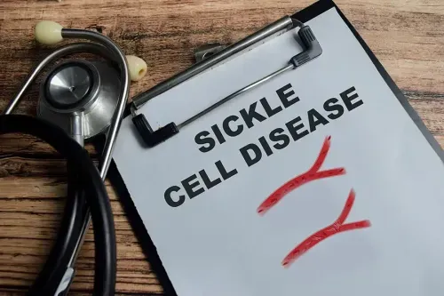 Sickle Cell Disease - An Overview