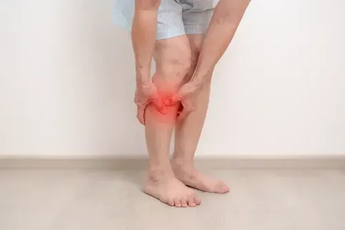 Varicose Veins: Causes & Treatment