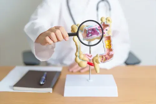 What are the Risk Factors for Colon Cancer?