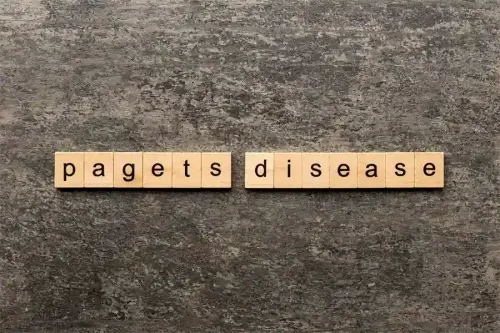 What are the Treatments for Paget's Disease?