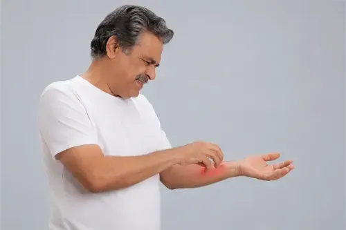 What Are the Two Signs of Ringworm?
