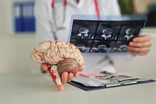 What Causes a Stroke to Happen?