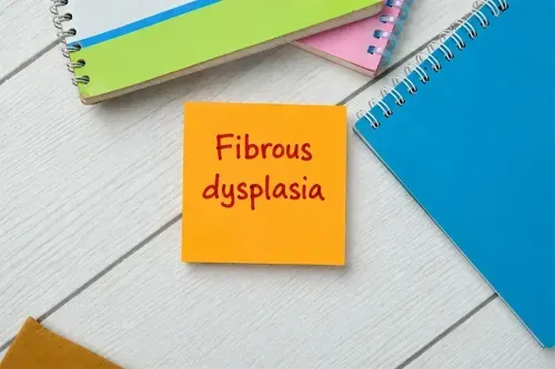 What is a Fibrous Dysplasia?