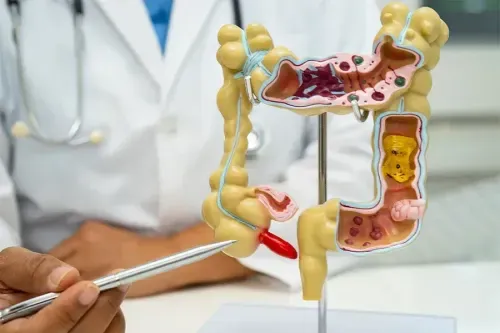 What is Appendicitis?