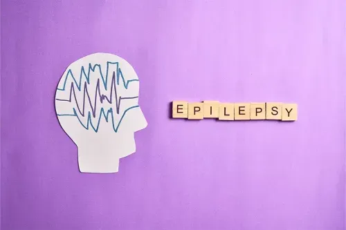 What is Dravet Syndrome in Epilepsy?