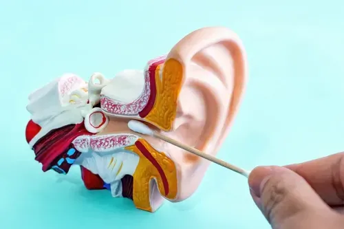 Earwax (Cerumen) Buildup: Causes, Symptoms & Removal