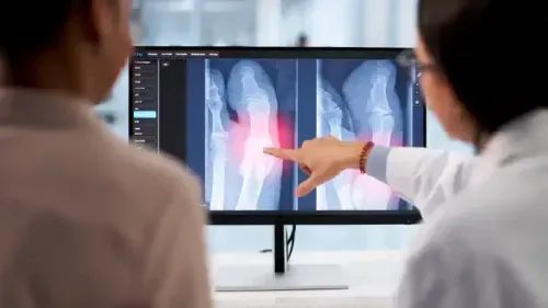 How Black Bone Disease Affects the Body