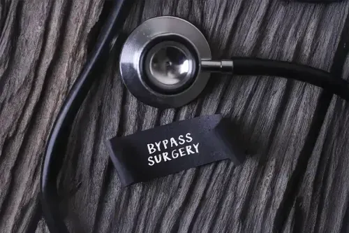 Heart Bypass Surgery (CABG) Information