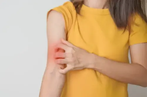 What is Leprosy Disease?
