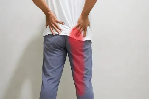  What is Sciatica Pain?