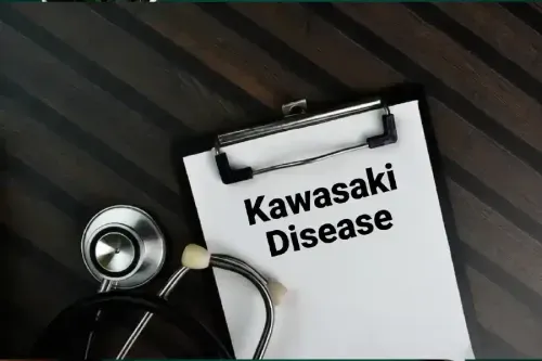 Treatment and Management of Kawasaki Disease