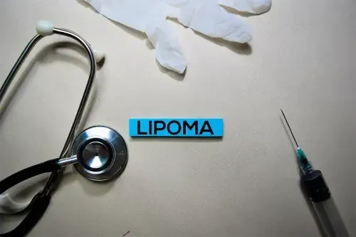 Lipoma Surgery Coverage - Know Its Potential Causes, Symptoms and Treatment