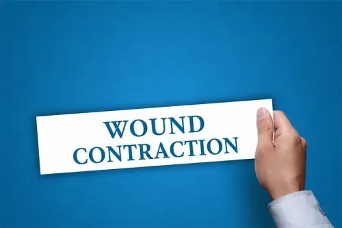What is Wound Contraction?