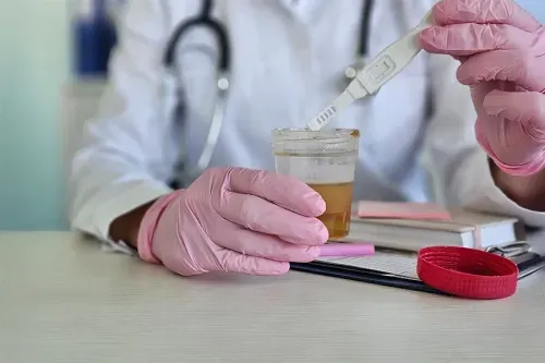 What the Colour of Your Urine Reveals About Health?