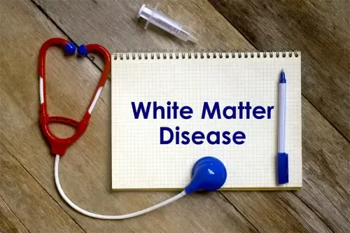 White Matter Function & Disorders - Brain Anatomy Explained